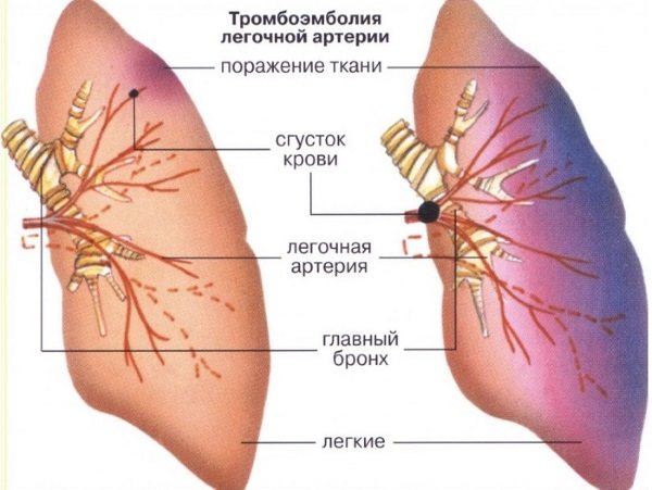 Боль под левой грудиной у женщин спереди при дыхании, движении, нажатии, после еды. Причины и что делать