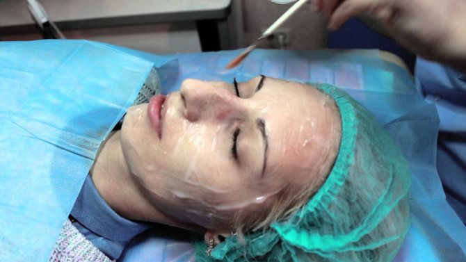 Для избавления от трышей на лице рекомендуют делать маску с использованием порошка Полисорба