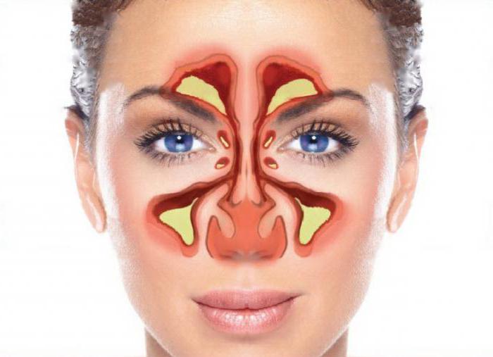 изофра с какого возраста применять