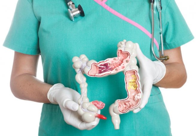 Какой врач занимается кишечником: определение, название, классификация и специфика работы врача-гастроэнтеролога