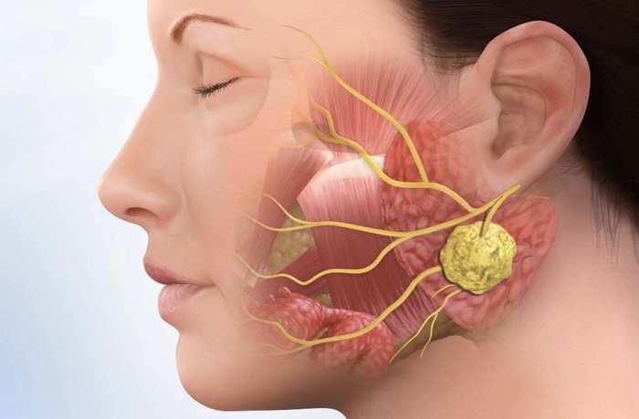 Лимфоузлы на голове. Расположение, схема, фото, где находятся. Симптомы воспаления, лечение