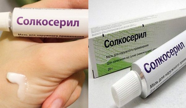Мазь Солкосерил — инструкция по применению