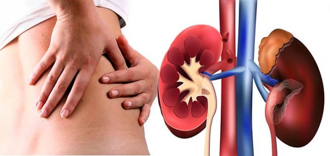 Патологии почек