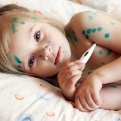 признаки ветрянки у ребенка