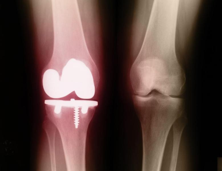 профилактика