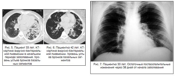 Рентгенограмма