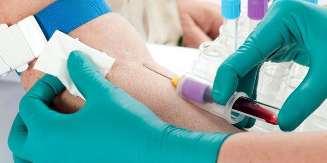 Врач берет кровь из вены на анализ