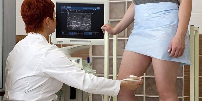 Женщине проводят ангиографию сосудов ног