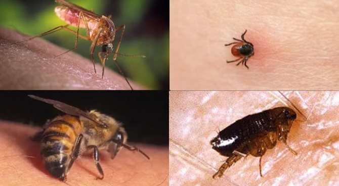 Жжение под левой лопаткой сзади со спины причины сильной боли